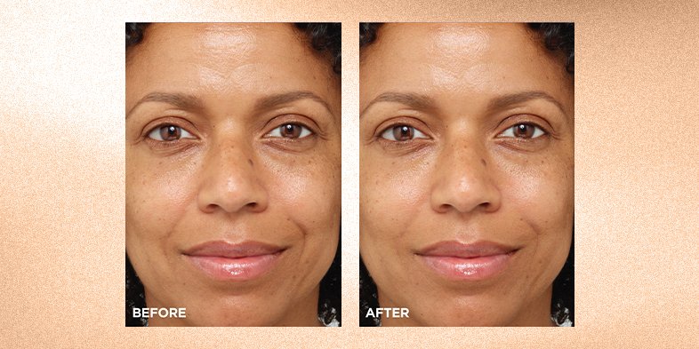 In-Article-water-based-hydration-for-any-skin-type_2